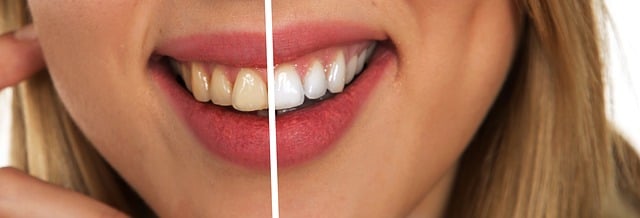 V lékárně pořídíte i kvalitní zubní péči